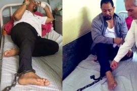 हटाइयो निलम्बित सांसद रेशम चौधरीको खुट्टामा बाँधिएको नेल