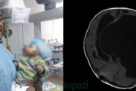 एकदिन झिपिक्क निभ्नेछ उनीहरूको ‘नयाँ संसार’